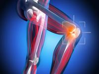 Applied Biologics advances osteoarthritis gene therapy program