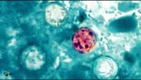 Who decides what is safe to eat: The cyclosporiasis outbreak and the failure of American food safety