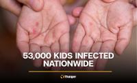 Thailand Reports 53,362 Hand, Foot and Mouth Disease Cases in 2026