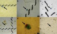 Researchers explore link between microplastics and lung cancer