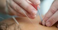 New acupuncture clinic to open in city this month to treat 'stress and burnout'