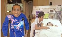 Once-conjoined Vietnam twin to visit Japan's Minamata disease areas