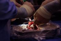 Science, pigs and money: the race between the US and China to make animal-to-human transplants viable
