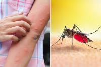 Dangerous mosquito-borne virus spreads in Florida as officials warn of rising cases
