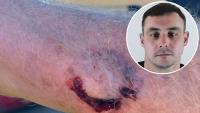 Drink driver Finnian Crook jailed for biting pensioner after Richmond crash