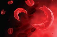 African drugmakers develop local treatments for sickle cell disease