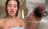 Montana Brown reveals she has been diagnosed with female pattern hair loss and says 'balding' has 'knocked' her confidence
