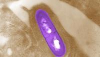 Pork products recalled for possible listeria contamination