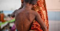 Bangladesh fights world's worst measles outbreak