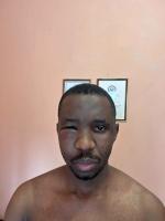 OUTRAGE GROWS OVER BOLOETSE ABDUCTION