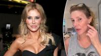 Brandi Glanville speaks out on complex diagnosis and $6K monthly medical battle