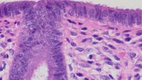 NC State Researchers Receive Federal Funding to Decode Key Uterine Function in Early Pregnancy