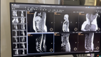 New MRI for state hospital