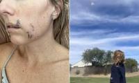 Arizona mother mauled by coyote while bravely fighting animal off four-year-old daughter