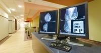 Health and wellness company begins selling mammography AI directly to consumers for $249