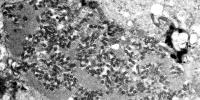 Health officials see a jump in human rabies exposures and mistakes in treatments, CDC says