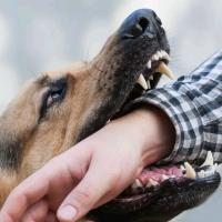 Dog bites Harare baby to death while in mother’s arms