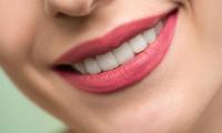 How Diet and Lifestyle Affect the Results of Teeth Whitening