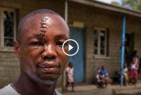 Kenyan Man Fought Off Machete-Wielding Attackers to Protect 37 Children at Orphanage