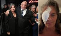 Tracey Emin reveals her brother Alan died while she was in hospital with 'sepsis and diverticulitis' as she shares she's been 'suffering for weeks' amid bladder cancer battle