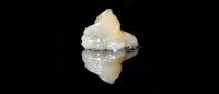 The Cold Stops the Clock: How Fresh Frozen Cannabis Becomes Live Rosin