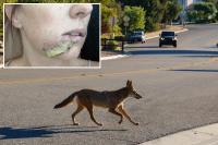 Arizona mom fights off crazed coyote with flip-flop after wild animal attacks 4-year-old daughter