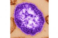 Pennsylvania officials report state’s 3rd death involving measles
