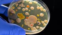 Study: Using antibiotics may make gonorrhoea more dangerous