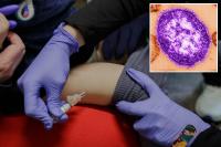 Pennsylvania woman dies from measles complications — third virus-related death in the state this year