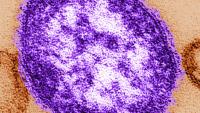 Pennsylvania officials report state’s third death involving measles