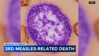 Public health advocate says Pennsylvania measles surge is a warning sign