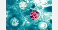Fresh produce industry marks close of cyclosporiasis outbreak