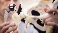 Health Check: Curvebeam AI shares double on crucial FDA orthopaedic clearance