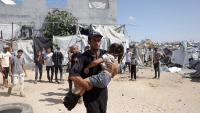 21 Palestinians injured as Israeli strikes continue in Gaza