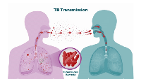 New “blockbuster” tuberculosis vaccines could save seven million lives by 2050