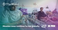 Measles cases continue to rise globally