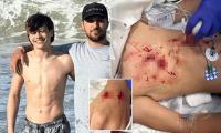 Boy, 14, viciously attacked by rabid beaver while swimming in Maryland park
