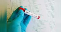 Chile, Bhutan show rabies can be beaten, but India’s 2030 target faces hurdles