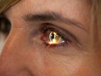 Swiss AI tech helps determine biological age from retina images