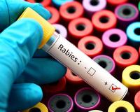 Public Health | Positive Rabies Test
