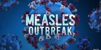 Kentucky health officials confirm 50 measles cases statewide. Here’s what counties near us have reported cases