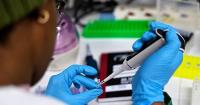 African lab scientists gather in Togo to discuss challenges amid Ebola crisis