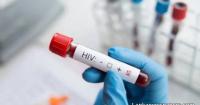 Fiji Declares National HIV Emergency Amid Alarming Rise in Infections