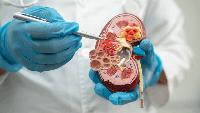 Kidney Research UK and Royal College of Nursing come together to strengthen kidney care