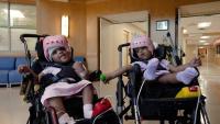 Twins conjoined at the head successfully separated after high-risk surgery, hospital announces