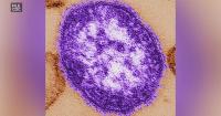 Maine confirms new measles case as officials warn of potential Waterville exposure