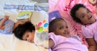 Conjoined twins separated in Ethiopia