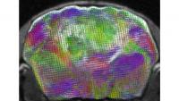 Stanford Scientists Replace Most of a Mouse Cortex With Human Brain Cells