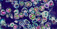 Measles in Wisconsin: 2 lab-confirmed cases in Vernon County