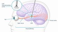 Amsterdam’s Phosphoenix raises €1.3 million to advance neuroprosthesis for profound blindness
